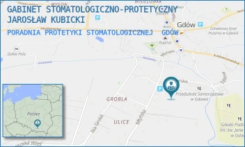 PORADNIA PROTETYKI STOMATOLOGICZNEJ - GABINET STOMATOLOGICZNO-PROTETYCZNY JAROSŁAW KUBICKI - UL. MŁYŃSKA 26,  GDÓW