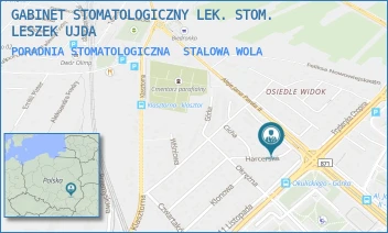 PORADNIA STOMATOLOGICZNA - GABINET STOMATOLOGICZNY LEK. STOM. LESZEK UJDA - UL. UL. HARCERSKA 4,  STALOWA WOLA