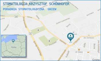 PORADNIA STOMATOLOGICZNA - STOMATOLOGIA KRZYSZTOF SCHÖNHOFER - UL. KOPERNIKA 16,  GNIEW
