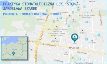 PORADNIA STOMATOLOGICZNA - PRAKTYKA STOMATOLOGICZNA LEK. STOM. JAROSŁAWA SZAREK - UL. ORZEPOWICKA 8D,  RYBNIK
