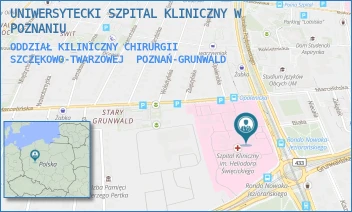 ODDZIAŁ KILINICZNY CHIRURGII SZCZĘKOWO-TWARZOWEJ - UNIWERSYTECKI SZPITAL KLINICZNY W POZNANIU - PRZYBYSZEWSKIEGO 49,  POZNAŃ-GRUNWALD